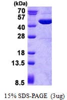 Human GOT2 Protein (Recombinant His)