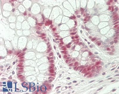 IHC-plus™ KLF5 / BTEB2 Antibody