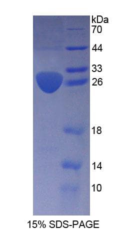 Human ARNT2 Protein (Recombinant His-T7)