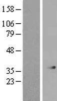 SERHL2 Protein (Over-Expression Lysate Myc-DDK (Flag))