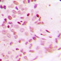 Polyclonal Rabbit anti-Human RELA / NFKB p65 Antibody (phospho-Thr254, IHC, WB)