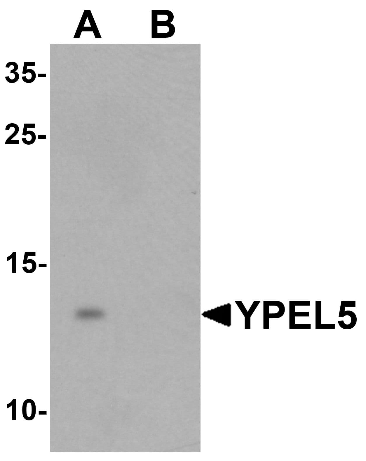 IHC-plus™ Polyclonal Rabbit anti-Human YPEL5 Antibody (IHC, IF, WB)