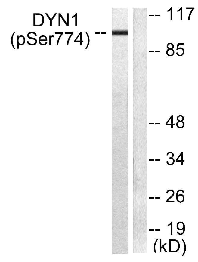 DNM1 / Dynamin Antibody (phospho-Ser774)