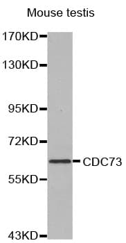 CDC73 / Parafibromin Antibody