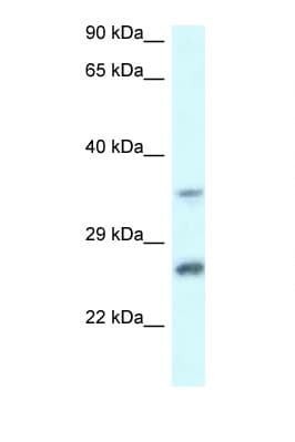 Polyclonal Rabbit anti-Human CBR4 Antibody (aa156-205, WB)