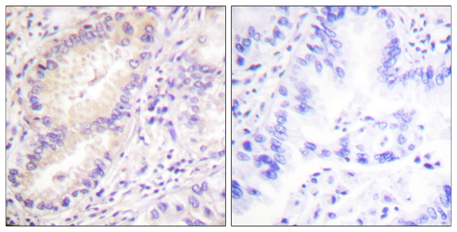 VASP Antibody