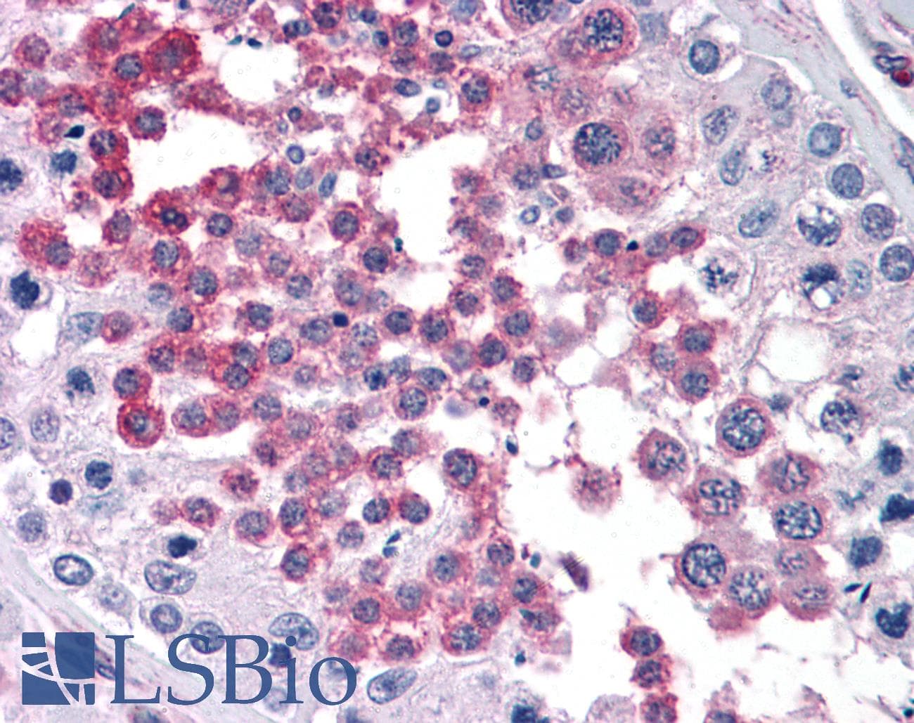 IHC-plus™ Monoclonal Mouse anti-Human RPS7 / Ribosomal Protein S7 Antibody (clone 3G4, IHC, IF, WB)