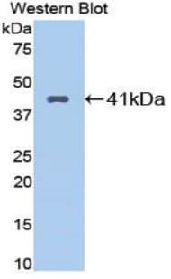 KNG1 / Kininogen / Bradykinin Antibody (aa22-379)