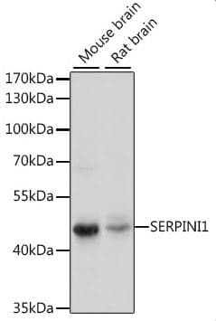 Neuroserpin Antibody (aa181-410)