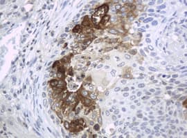 Monoclonal Mouse anti-Human WFDC2 / HE4 Antibody (clone OTI1E12, aa31-124, IHC, WB)