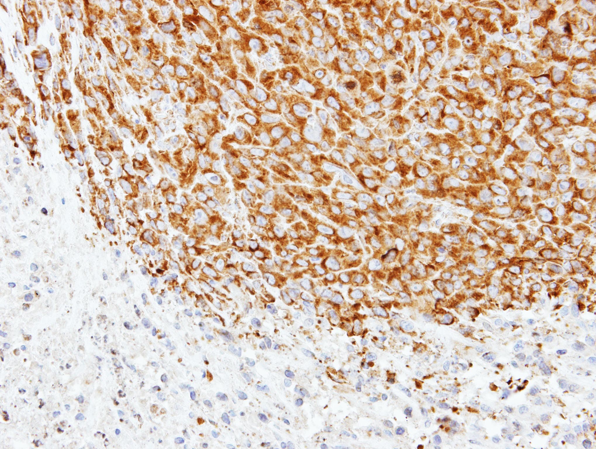 TUBA1A / Tubulin Alpha 1a Antibody (aa37-276)