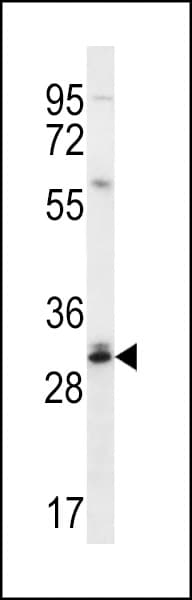 CTDNEP1 / DULLARD Antibody (aa131-160)