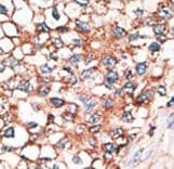Polyclonal Rabbit anti-Human GJA9 / CX59 / Connexin 59 Antibody (aa484-515, IHC, WB)