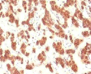 KRT18 / CK18 / Cytokeratin 18 Antibody (clone CTKN18-1)