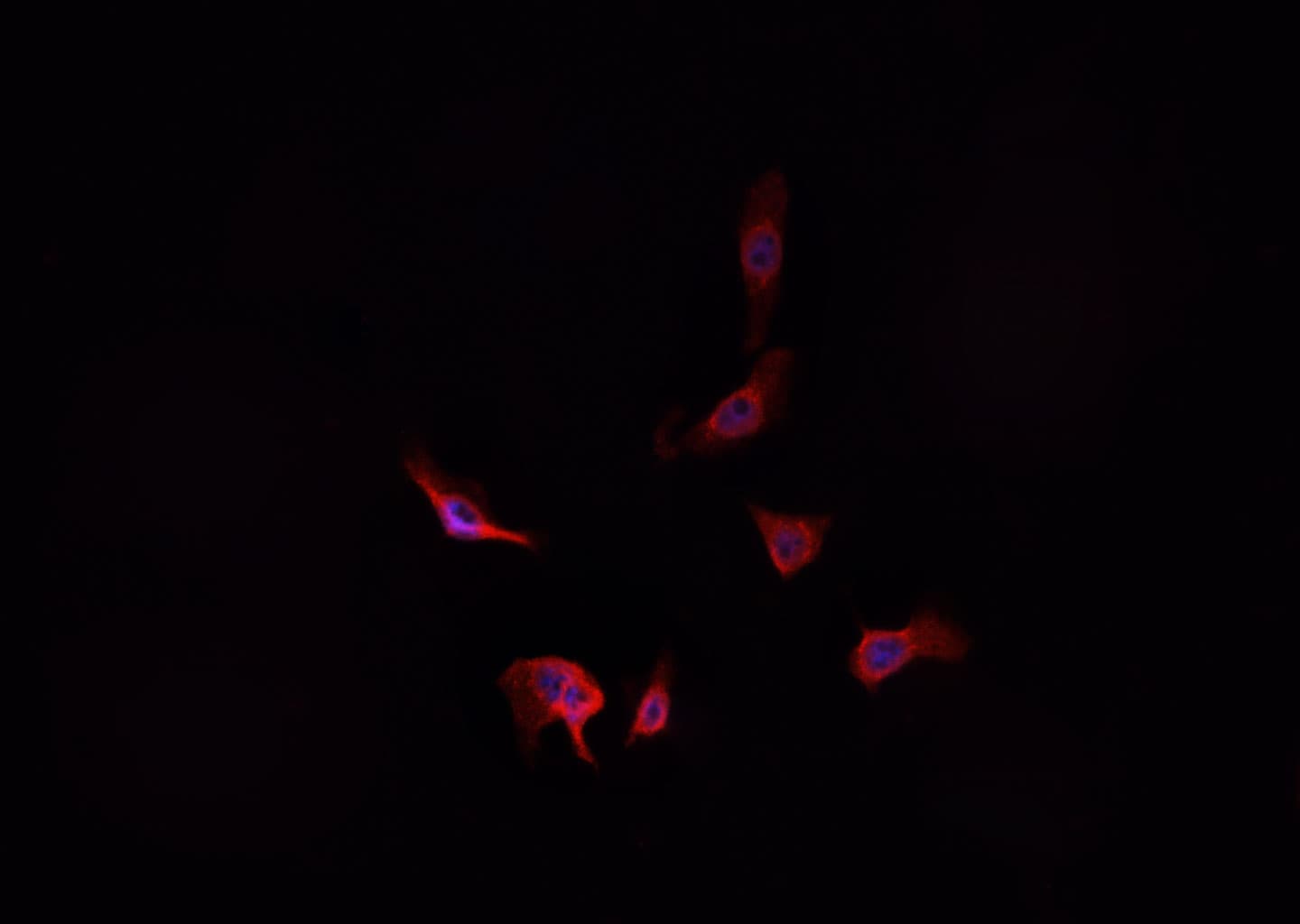 ADD1 / Adducin Alpha Antibody