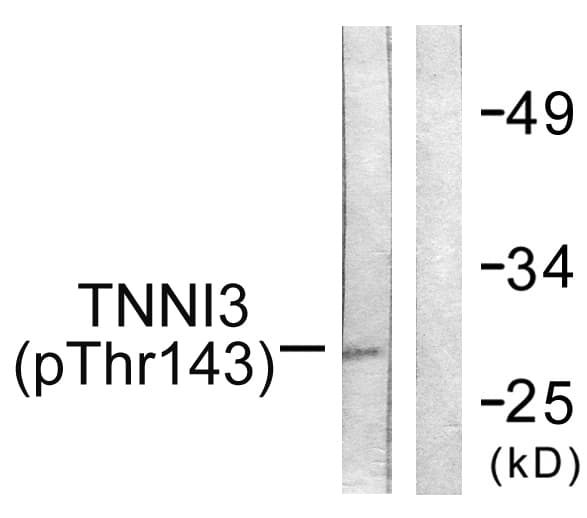 TNNI3 / Cardiac Troponin I Antibody (phospho-Thr142)