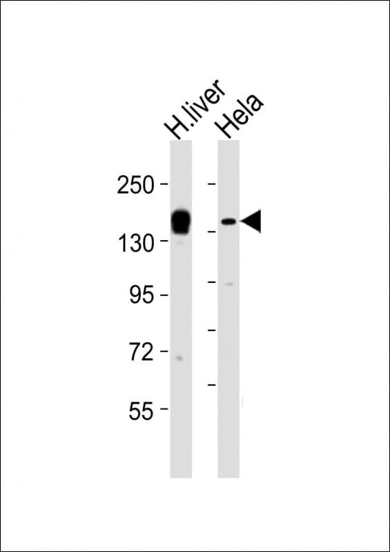 KDM6A / UTX Antibody (aa797-832)