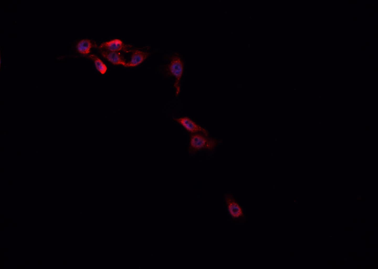 MED14 Antibody