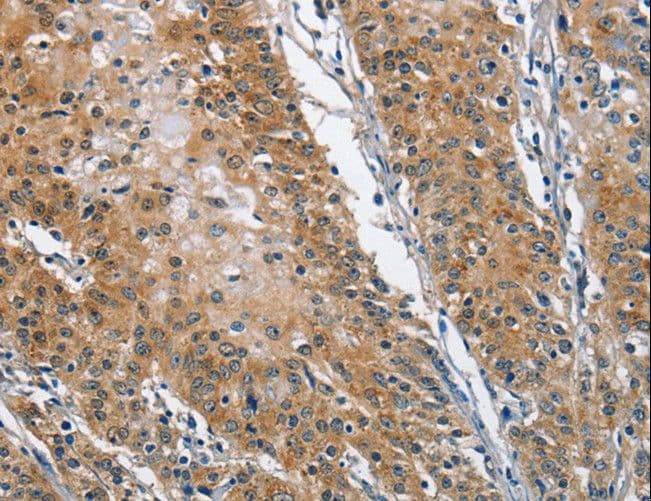 TRIP4 / ASC-1 Antibody