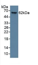 KRT9 / CK9 / Cytokeratin 9 Antibody