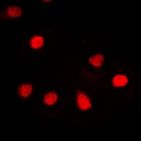 Polyclonal Rabbit anti-Human RBMX Antibody (N-Terminus, IHC, IF, WB)
