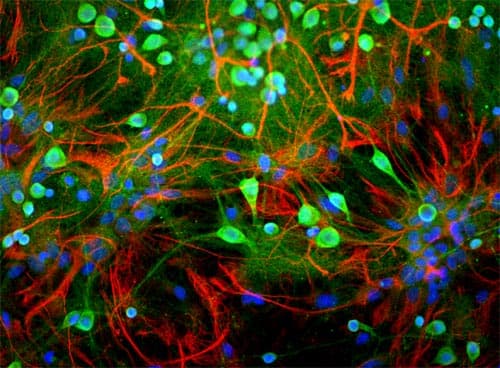 Polyclonal Chicken anti-Human UCHL1 / PGP9.5 Antibody (IF, WB)