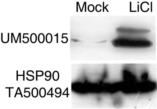 Monoclonal Mouse anti-Human CTNNB1 / Beta Catenin Antibody (clone UMAB15, Carrier-free, IHC, IF, WB)