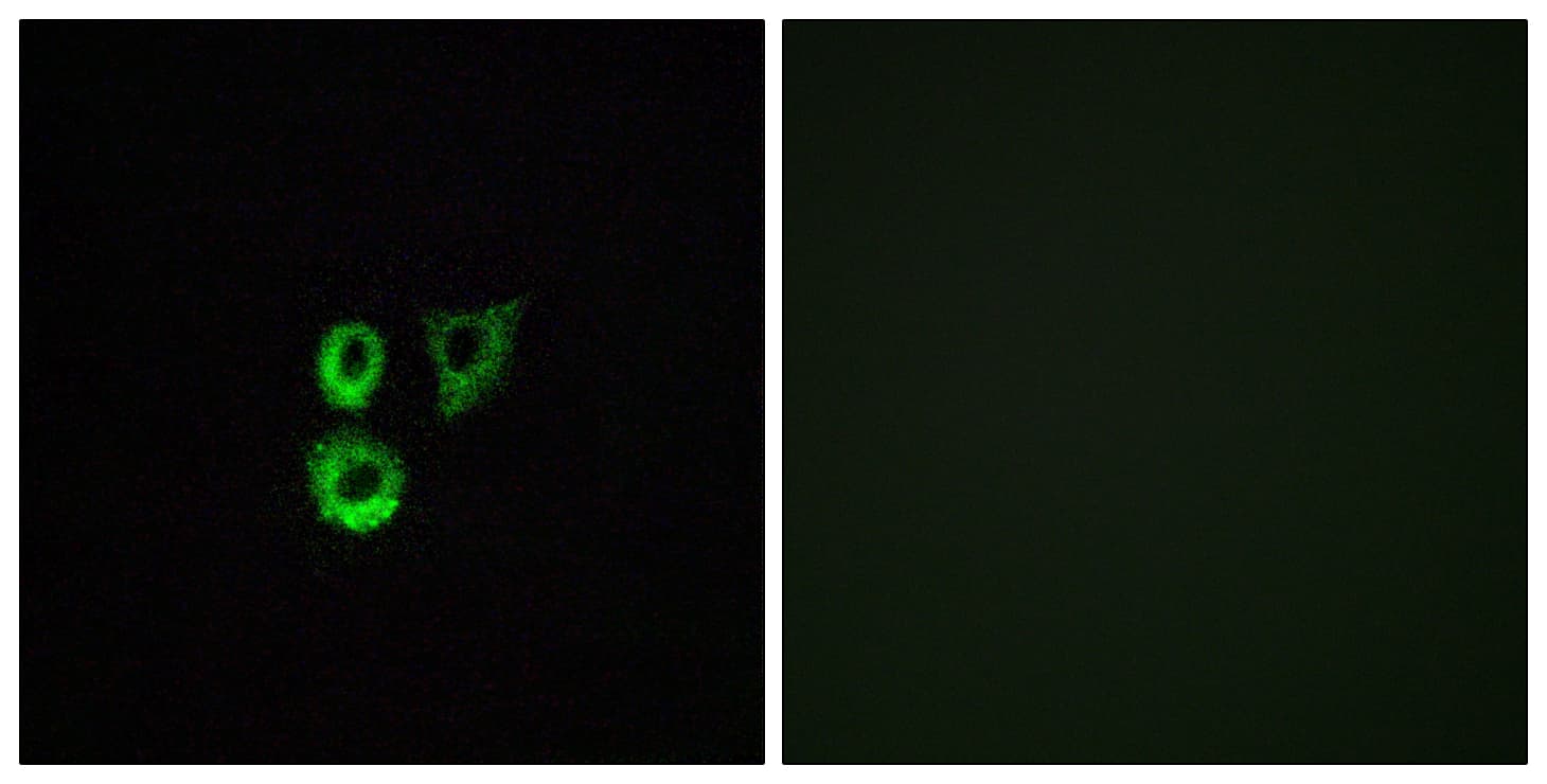 OR2T3 + OR2T34 Antibody (C-Terminus)