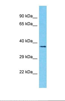 OR1J4 Antibody (aa237-286)