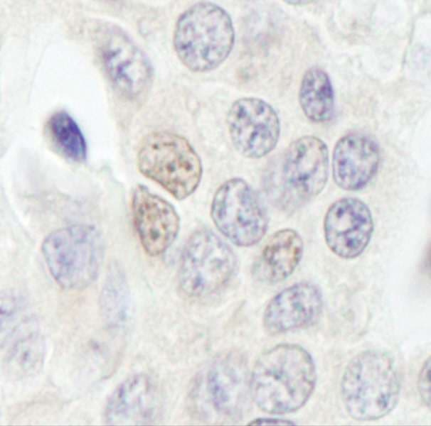 Polyclonal Rabbit anti-Human RBM27 Antibody (aa975-1025, IHC, WB)