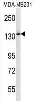Polyclonal Rabbit anti-Human PIK3R4 Antibody (aa819-847, WB)