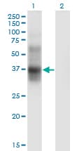 Monoclonal Mouse anti-Human IL2RA / CD25 Antibody (clone 1D6, WB)