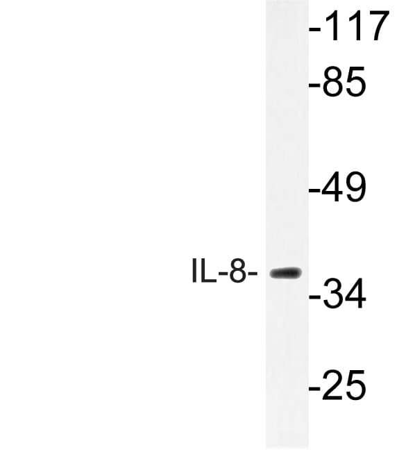 IL8 / Interleukin 8 Antibody (Val68)
