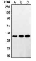 RNF144A / RNF144 Antibody (Internal)