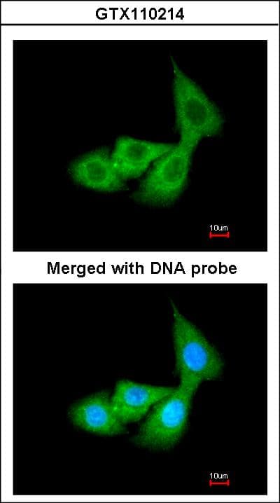 SERPINA6 / CBG Antibody (aa105-353)