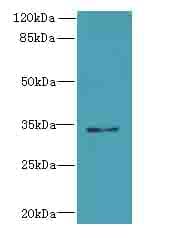SLC25A18 Antibody