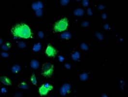 Monoclonal Mouse anti-Human LPL / Lipoprotein Lipase Antibody (clone OTI4G7, IHC, IF, WB)