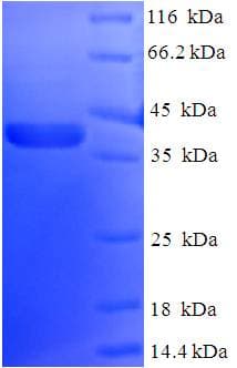 Human NOL3 / ARC Protein (Recombinant His-SUMO)