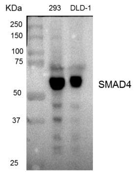 Polyclonal Rabbit anti-Human SMAD4 Antibody (IHC, IF, WB)