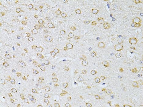 NTS / NT / Neurotensin Antibody