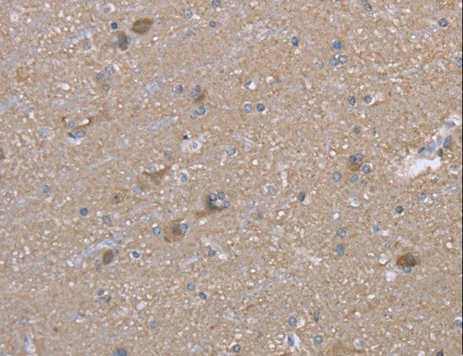 Polyclonal Rabbit anti-Human MAPRE3 / EB3 Antibody (IHC, WB)