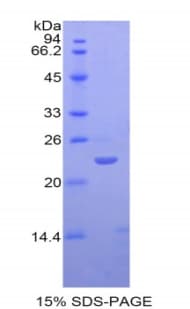 Human SIGLEC12 Protein (Recombinant His)