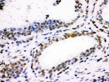 CDK1 / CDC2 Antibody