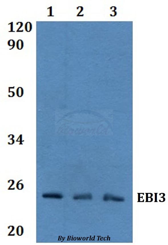 Polyclonal Rabbit anti-Human EBI3 / IL-27B Antibody (WB)