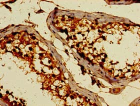 Polyclonal Rabbit anti-Human C3orf14 Antibody