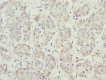Polyclonal Rabbit anti-Human PEX14 Antibody (IHC)