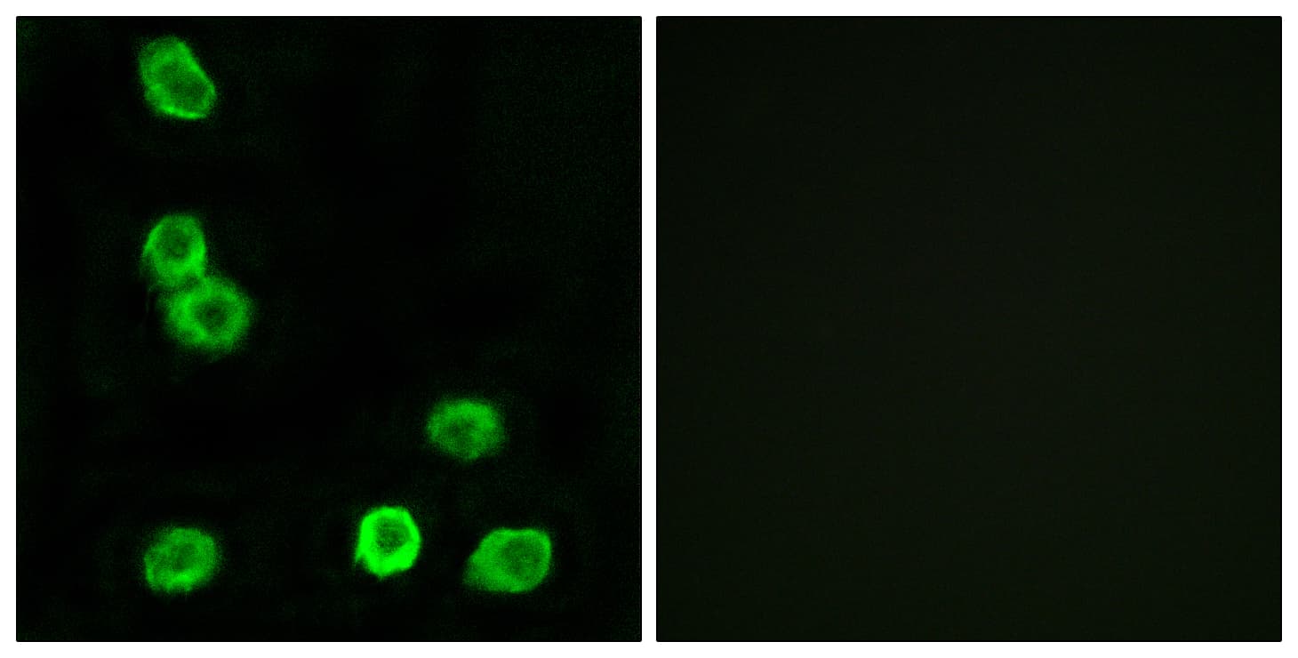 Polyclonal Rabbit anti-Human GPR63 Antibody (aa370-419, IF)