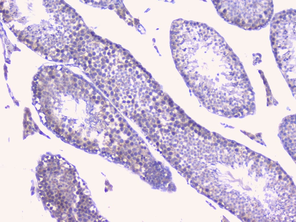 Polyclonal Rabbit anti-Human PTP1B Antibody (IHC, WB)