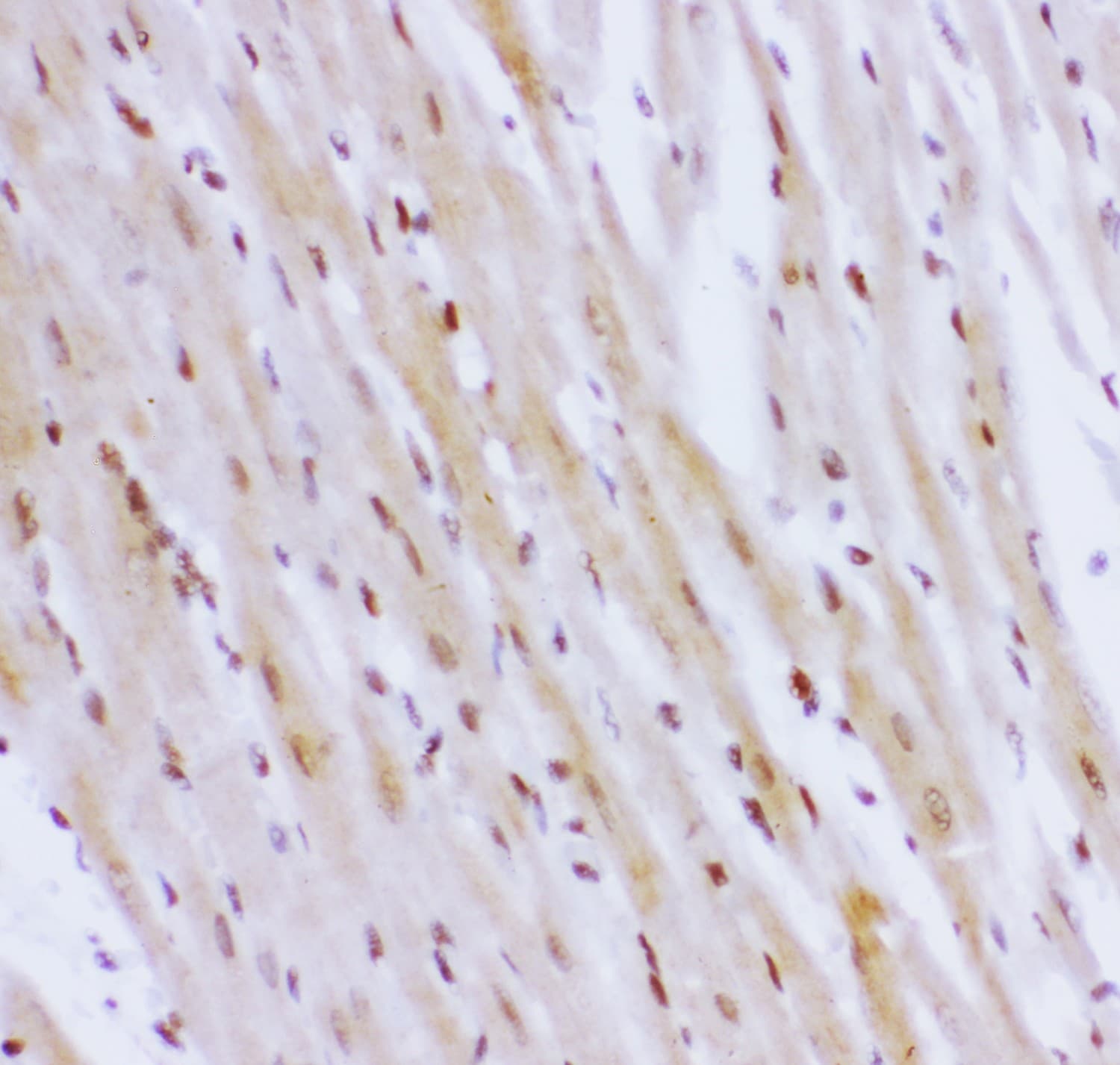 NR3C1/Glucocorticoid Receptor Antibody (aa1-373)
