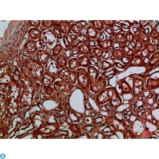 EYA1 Antibody